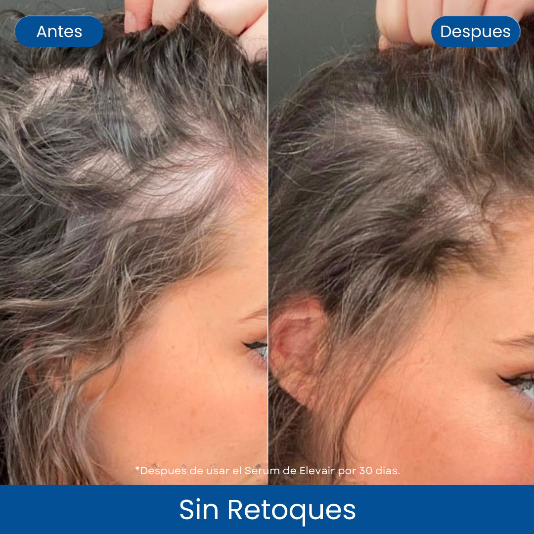 Serum Capilar en Roll-On de Elevair