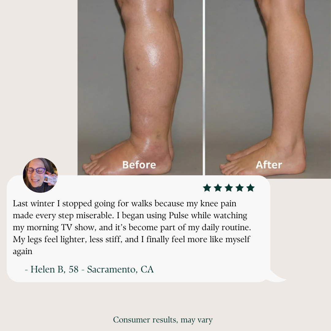 Pulse™ Vibration Plate