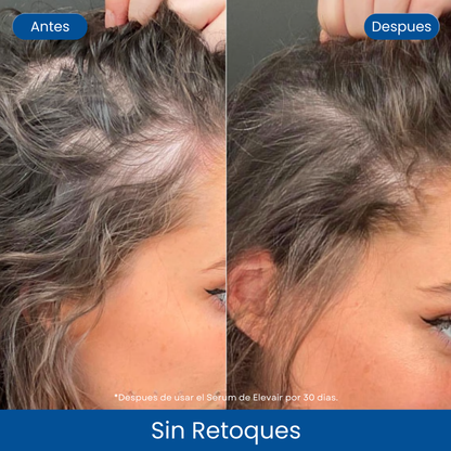Serum Capilar en Roll-On de Elevair